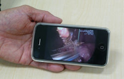 写真1●コヴィディエン ジャパンの営業担当者が動画で医療機器のプレゼンテーションをする様子