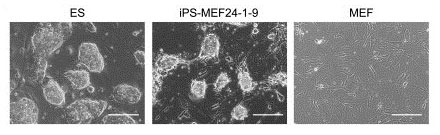 図1●ES細胞、iPS細胞、皮膚の細胞の写真 左がES細胞（ES）、中がiPS細胞（iPS-MEF24-1-9）、右が皮膚の細胞（MEF）